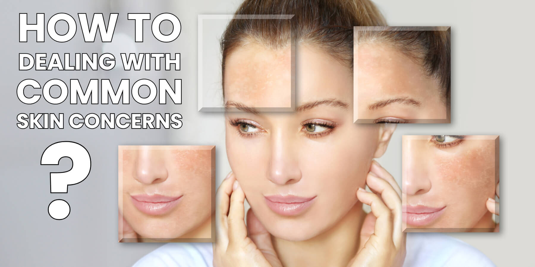Manage Skin Concerns in Sri Lanka’s Climate Skincare solutions for acne, hyperpigmentation, and sun damage in Sri Lanka