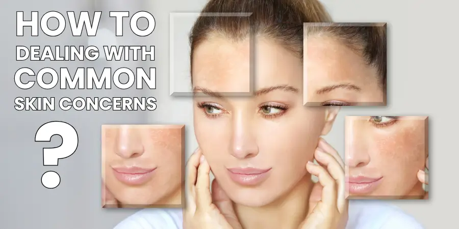 Skincare solutions for acne, hyperpigmentation, and sun damage in Sri Lanka