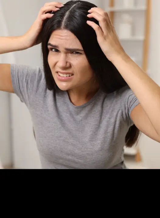 Dandruff & Flaky Scalp