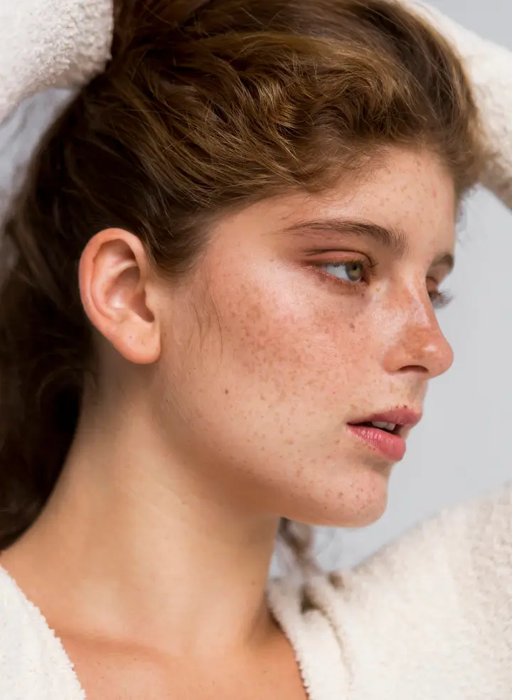 Dark Spots & Hyperpigmentation