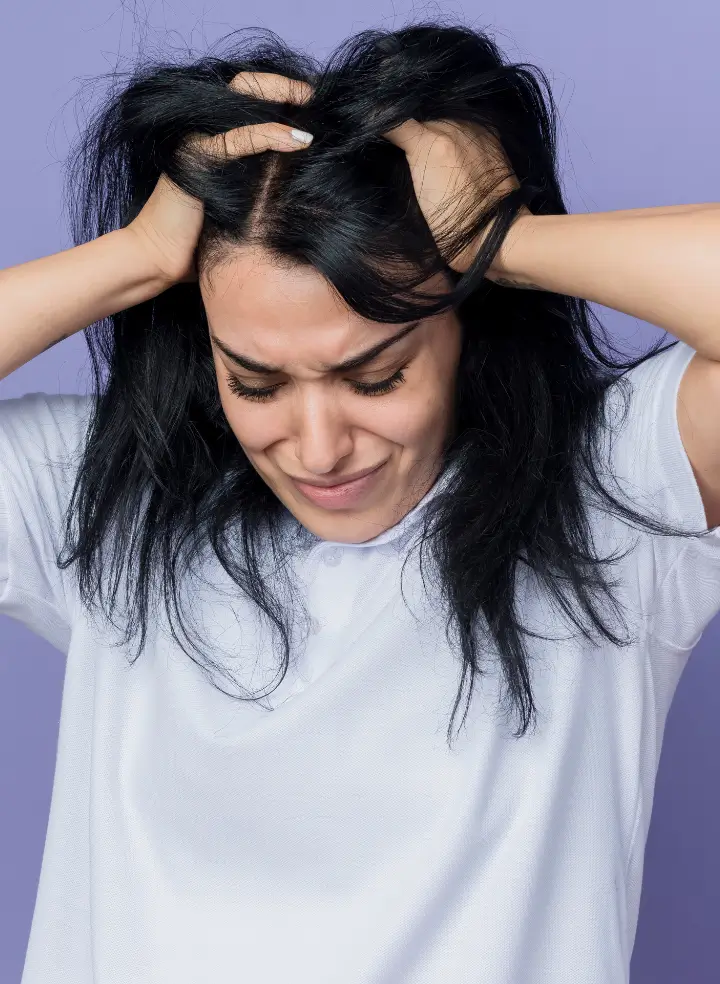 Dandruff & Flaky Scalp